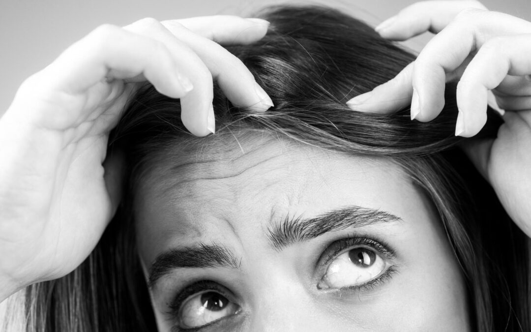 Understanding Trichotillomania and How to Get Help