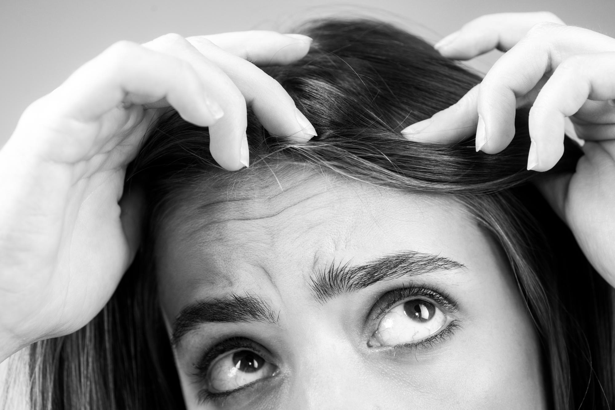 Understanding Trichotillomania and How to Get Help